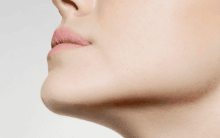 radion frequency rf treatments