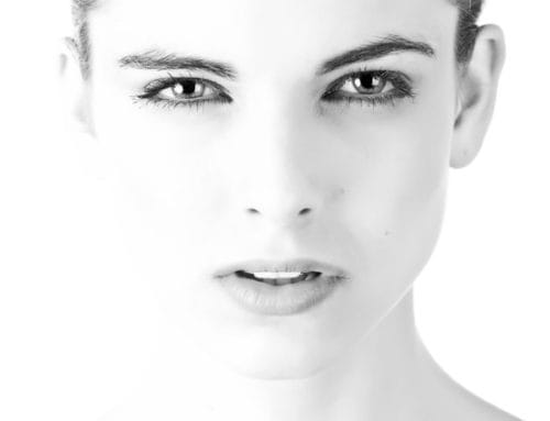 Acne Scar Treatment