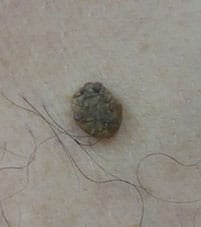 Mole 1 B