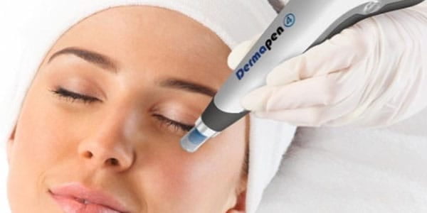 dermapen offer