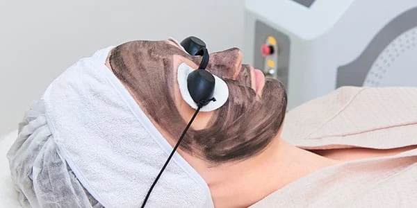 carbon-peel-mark carbon peel mark