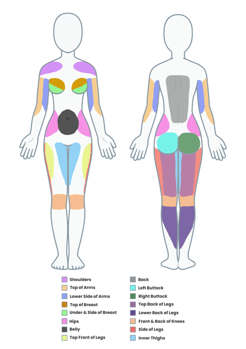 Stretch Mark Locations