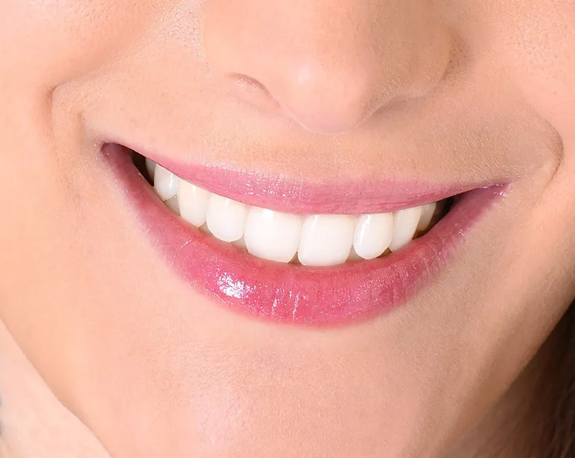 closeup of smile with white healthy teeth 2024 10 22 21 30 26 utc (1) min