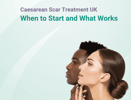 Caesarean Scar Treatment