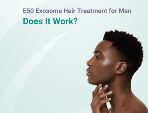E50 Exosomes for Male Hair Loss