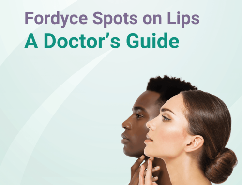 Fordyce Spots on Lips: A Doctor’s Guide to What They Are, What They Aren’t, and How to Remove Them